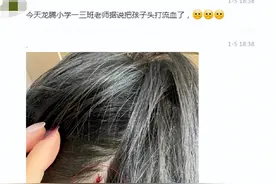 郑州一小学生被老师打破头，同校家长：我们的心情是矛盾的图片