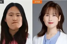 “歪脸女”赵宏秋：2020年整容变美女，拒百万年薪，只想当老师图片