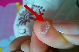 小脚趾指甲分成两瓣的人，到底有什么来头？是纯种汉族的证明吗？图片