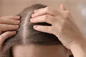 11个生活妙招，头皮屑多惹人烦，将它涂抹在头发上，永无头屑烦恼图片