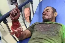 难以想象！菲律宾男子被巨蟒缠身，疯狂咬蛇的脖子自救图片