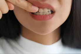 “牙结石”自己抠掉行吗？教你几招，牙缝脏东西或能轻松掉图片