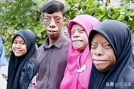 一张“马脸”代代相传？父亲的基因太强大，子女有苦也说不出！图片