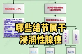 哪些结节属于浸润性腺癌#磨玻璃结节 #肺结节视频封面