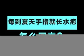 夏天手上就长这种#水泡 是怎么回事？#皮肤管理 #健康科普