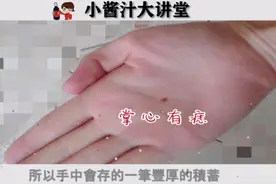 手上长痣代表什么？位置不同运势大不相同，看看你手上的痣