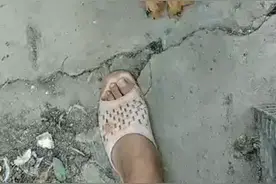 病鸡劈叉，马立克的典型症状，养鸡人收藏一起吧！