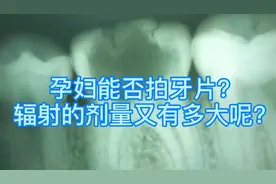 拍摄X光片的辐射大吗？孕妇能否拍牙片？拍牙片辐射剂量是多少？