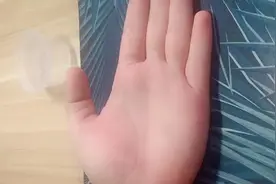 01健康纹断断续续的，代表肠胃消化不良视频封面