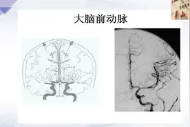 大脑前动脉血管解剖与造影解读视频封面
