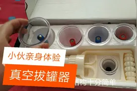 小伙亲身体验真空拔罐器，效果真的比火罐好吗？