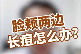 脸颊两边长痘，痘痘又大又痛，多半是肝火，用它能搞定