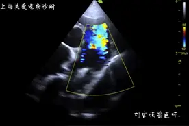 这只狗狗厉害了，先天性心脏病PDA，DA最大流速6m/s，9岁了视频封面