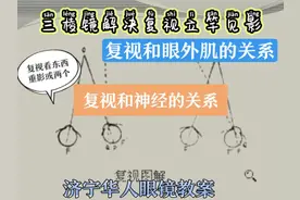 复视视物重影一个变两个，复视与眼外肌和神经之间的关系