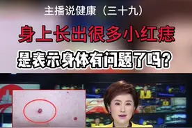 身上长出很多小红痣，是表示身体有问题了吗？#主播说健康视频封面
