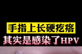 手指上长了硬疙瘩，以为是茧子？皮肤科医生提醒你这是感染了HPV #医学科普 #寻常疣 