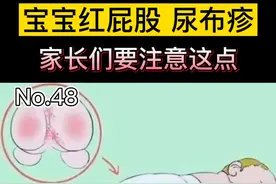 夏天到了，宝宝红屁股很常见，家长们对#宝宝护理 要更细心#科普 #尿布疹视频封面