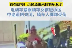 看着都疼！小区有这种门禁的都来看看  #门禁人脸识别