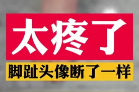 太疼了，脚趾头像断了一样#横弓塌陷 #脚痛 #老茧 #脚丫子 #关爱家人健康 #健康养生 #高跟鞋 #健康科普视频封面