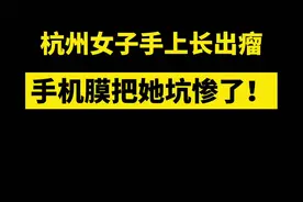 #可怕 ！#杭州 一女子被#手机膜 碎片扎手后疼痛不止，3个月后发现长出了#瘤……@抖音短视频