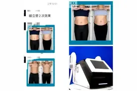 美修斯系统#减脂塑形 #身材管理是女人一生的必修课