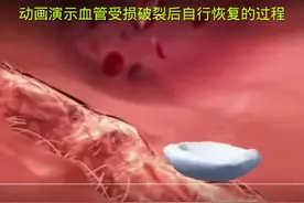 动画演示血管受损破裂后自行恢复的过程#小科普系列 #医学常识