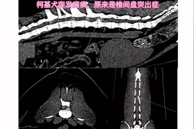 神经疾病通常是难诊断难治疗的，柯基犬突然后肢4-5级瘫痪视频封面