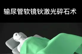 肾结石#输尿管软镜钬激光碎石术#动画演示，仅供参考#医学科普 视频封面