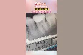 13岁女孩做根管治疗针管断牙龈里，妈妈：金属针管离神经很近