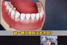 #dou出新知 #轻知识计划 牙齿缺失，别当儿戏了，会引发整个口腔的问题，转发给家人看看吧@抖音短视频