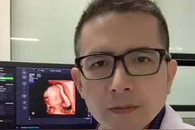 三维四维彩超会检查胎儿的手指脚趾吗？#怀孕 #胎儿 #产检 #四维#四维彩超视频封面