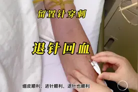 留置针穿刺日常分享……退针回血，补救的前提是未刺破血管