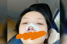 《快乐星球》冰柠檬扮演者张兆艺遭家暴，自曝自己遭妈妈家暴，她的鼻头包裹着纱布，看着让人十分的心疼#娱乐评论大赏视频封面