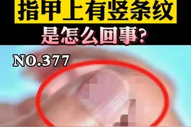 指甲有一条条淡淡的竖纹，该怎么办？#指甲 #科普 #竖纹指甲 