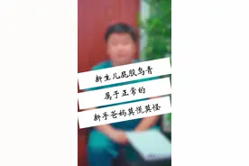 宝宝出生后身上有“淤青”，好久都没有下去，影响健康吗？ #健康  #医学科普视频封面