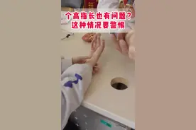 个子高手指长也有问题？快看看你家孩子是不是#马凡综合征 #先心病 #医学科普 #门诊日常