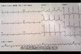 #心电图能检查出哪些疾病？视频封面