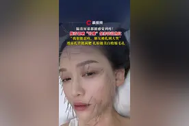 陈乔恩晒“针雕”保养法引热议！透露扎背能减肥，扎脸能美白收缩毛孔#陈乔恩