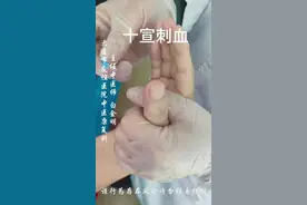 #穴位 #扎针 #急救 #退热 #十宣放血