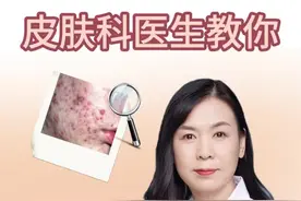 痤疮能治愈吗？#医学科普 #痤疮 #美容护肤小知识