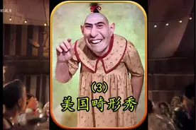 国外男子天生畸形长了三条腿，拥有两套生殖系统，是好还是不好呢