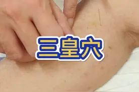 #中医 #经络穴位 #扎针