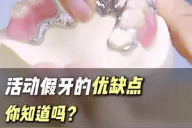 活动假牙优缺点剖析 #种植牙 #舒林径 #硬核健康科普行动 #活动假牙 #重庆