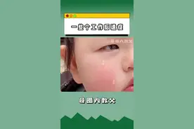 #我的工作后遗症 你会有工作后遗症吗？视频封面