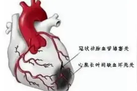 #医学科普  有胸痛到医院（拨打120），到胸痛中心去！