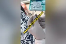 全网唯一：1分钟学会调节哈雷保持器#牙齿矫正 #正畸 #口腔科普 #整牙历程 #戴牙套