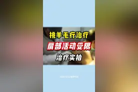 肩背筋膜炎#挑羊毛疔 #中医