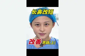 长鼻改短·改善思路#隆鼻 #变美 #鼻子