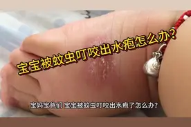 宝妈宝爸们，夏季宝宝被蚊虫叮咬出水疱怎么办？#育儿