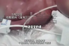 5月22日，河南郑州（发布）。“她真的好顽强，两个月闯关成功！”  25周超早产儿只有巴掌大小！ 体重700克 血管清晰可见，现在长到1.1公斤！宝贝，加油！